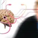 Il morbo di Parkinson: cause, sintomi e gestione della malattia